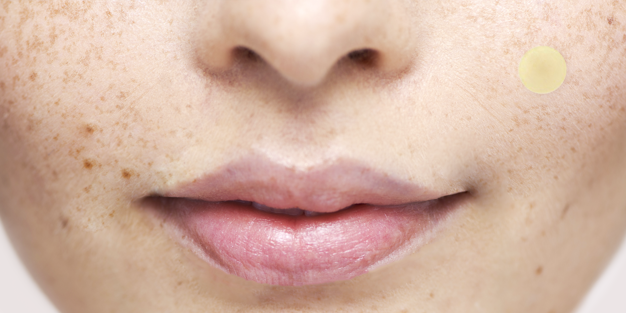 Pimple Sticker Benefits Best Way to Zap Zits